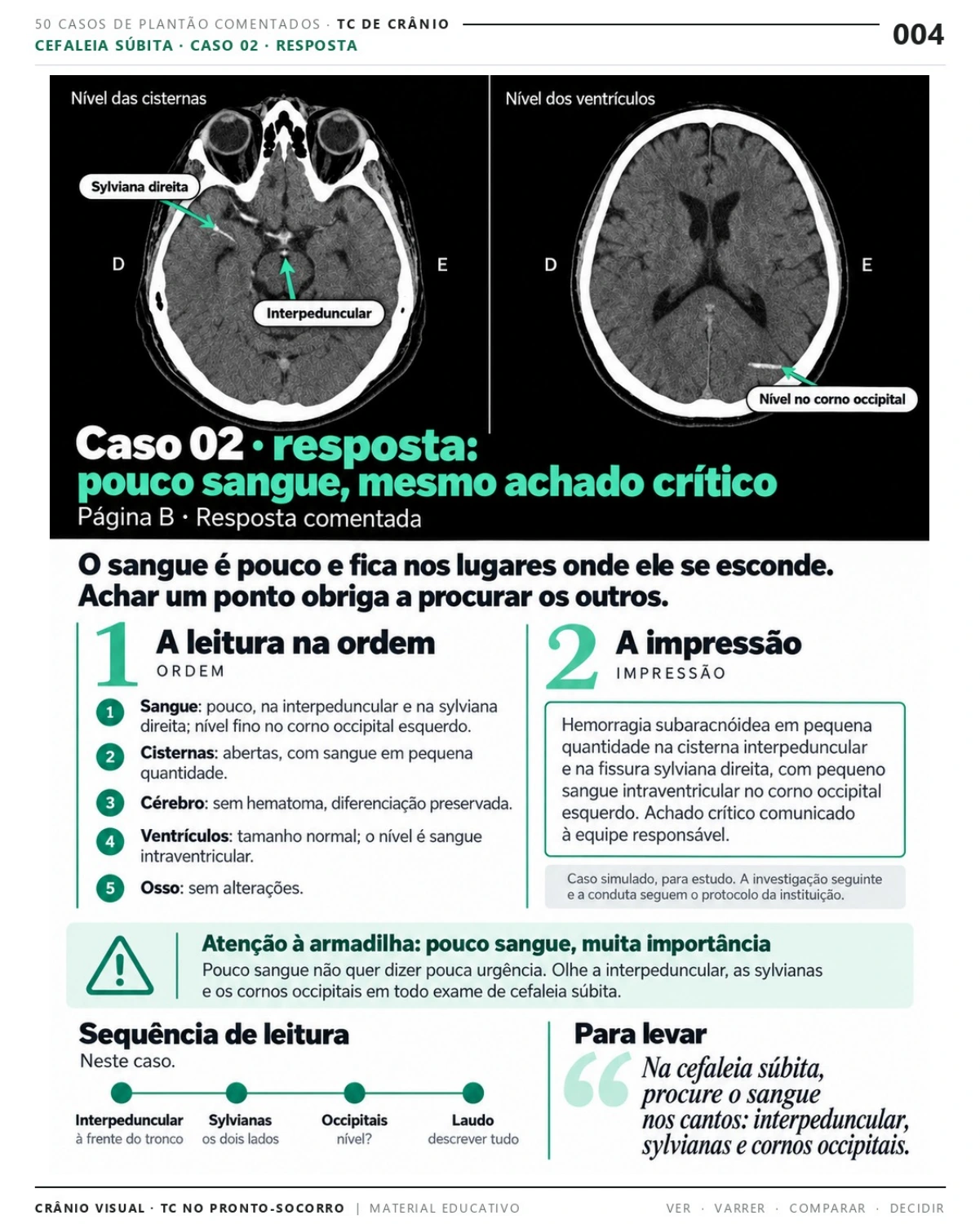 Página 4: Caso 02: resposta comentada. Prévia do PDF Crânio Visual TC; imagens didáticas simuladas.