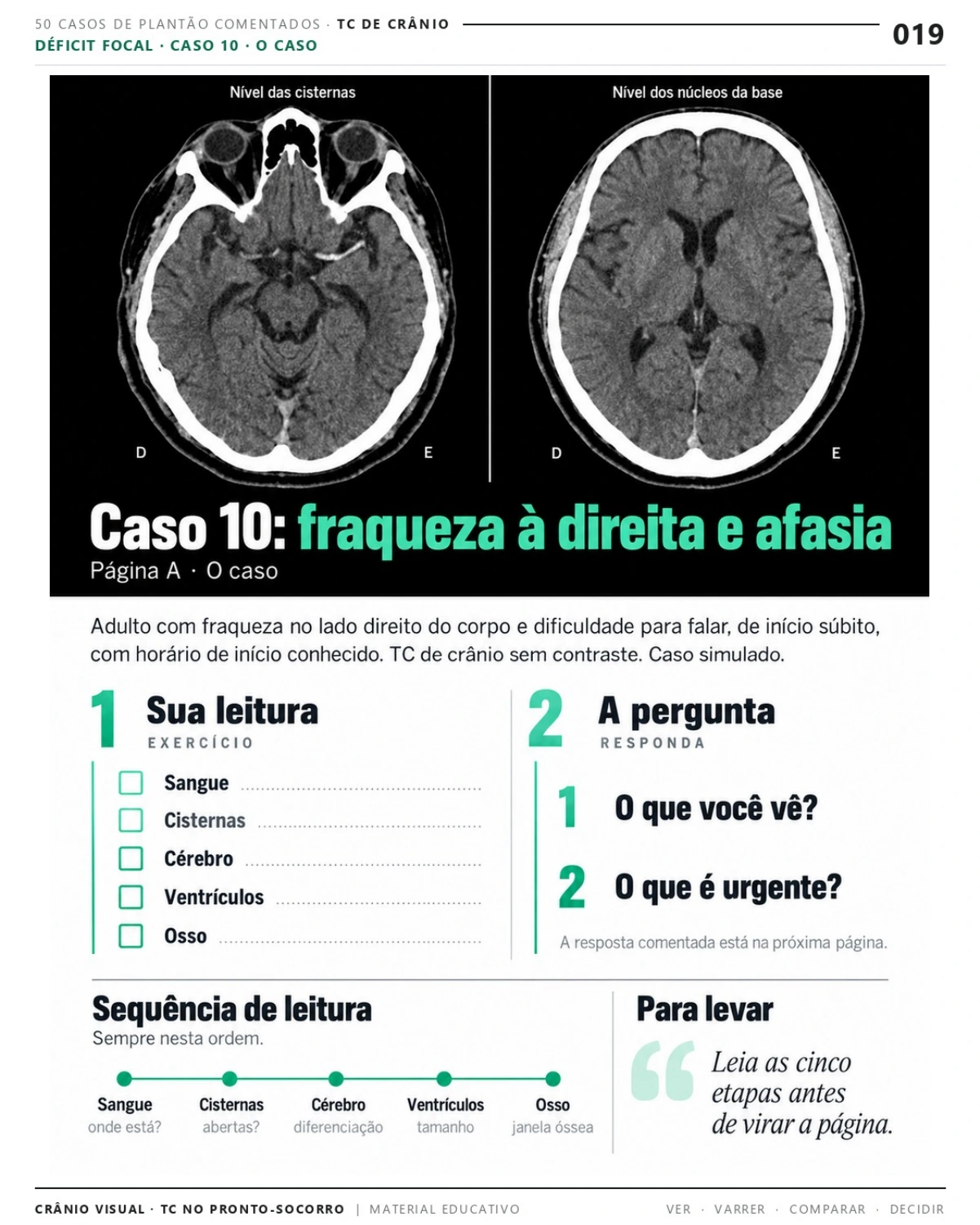 Página 19: Caso 10: fraqueza à direita e afasia. Prévia do PDF Crânio Visual TC; imagens didáticas simuladas.
