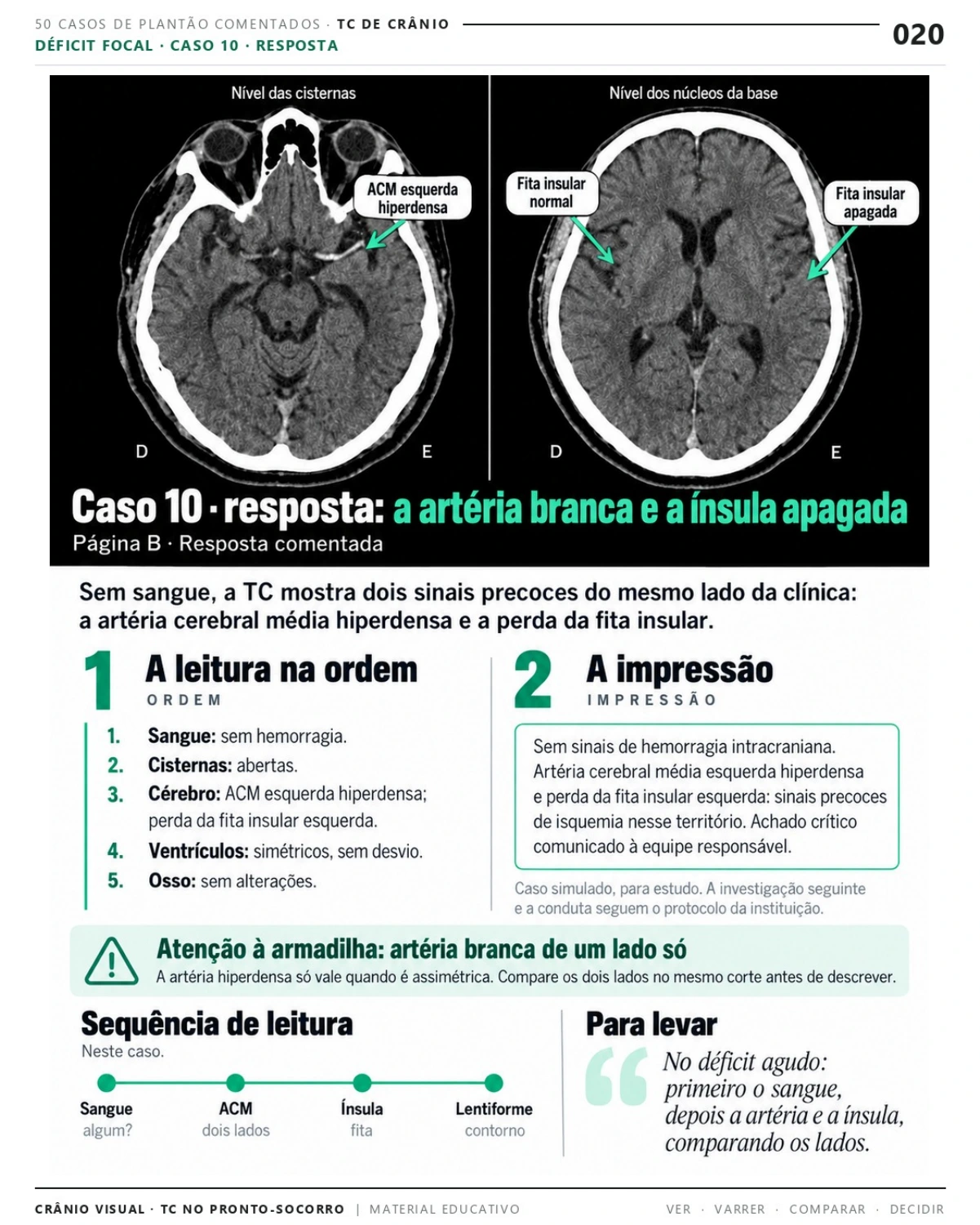 Página 20: Caso 10: resposta comentada. Prévia do PDF Crânio Visual TC; imagens didáticas simuladas.