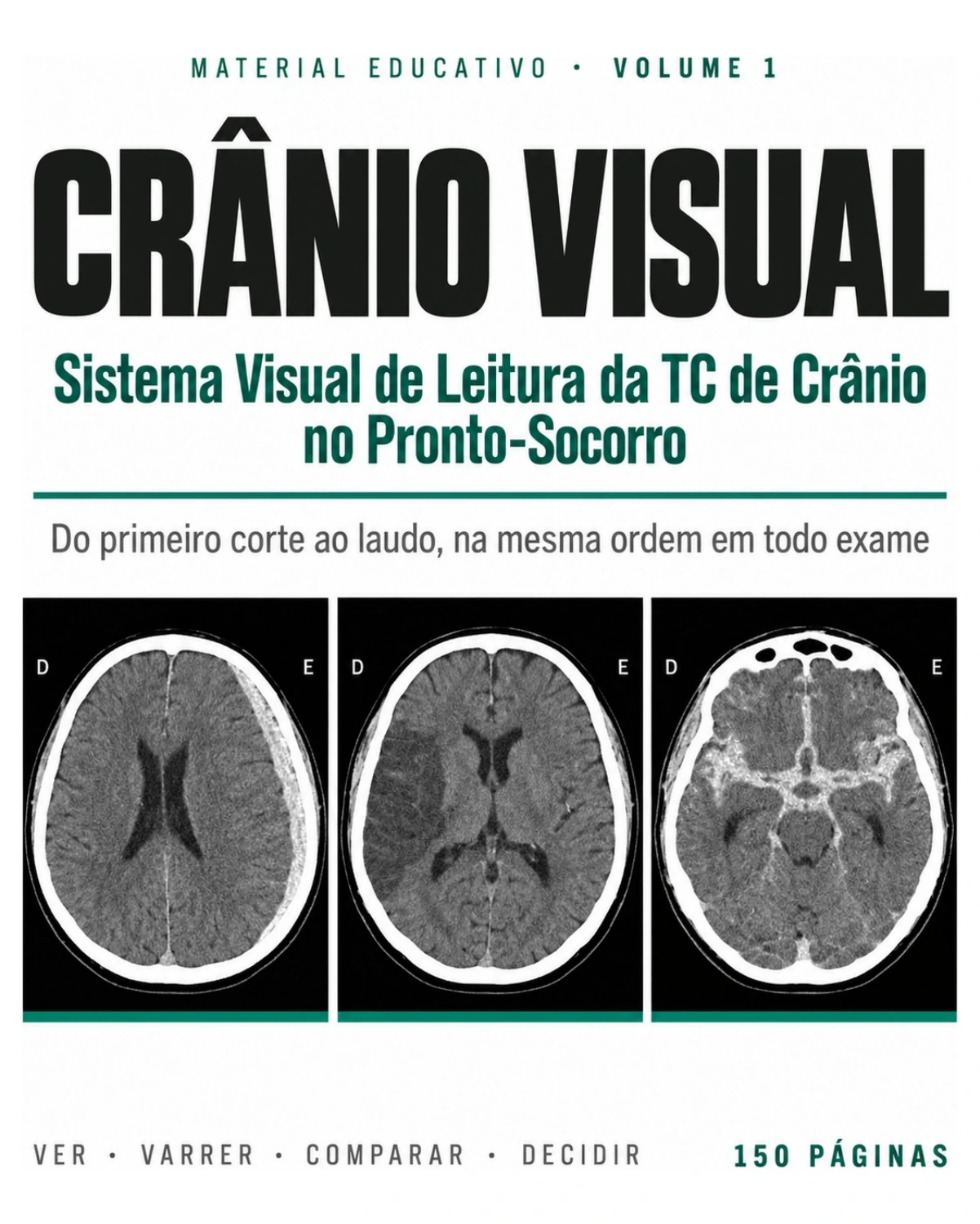 Página do PDF: Sistema Visual de Leitura da TC de Crânio no Pronto-Socorro