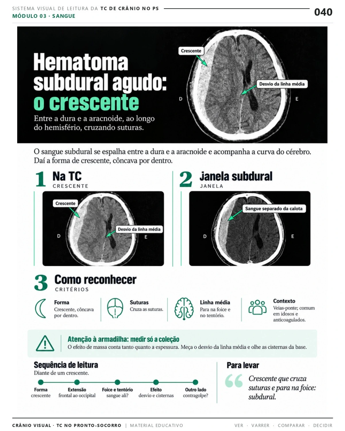 Página 40: Hematoma subdural agudo: o crescente. Prévia do PDF Crânio Visual TC; imagens didáticas simuladas.