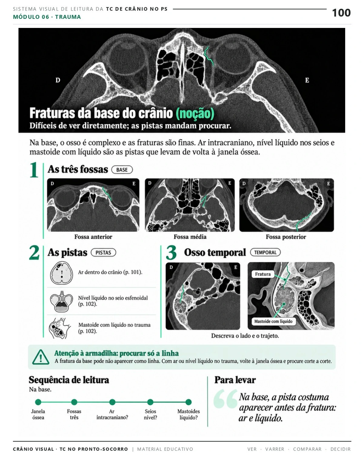 Página 100: Fraturas da base do crânio: noções. Prévia do PDF Crânio Visual TC; imagens didáticas simuladas.